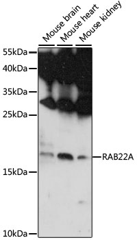 Western blot - RAB22A Polyclonal Antibody 