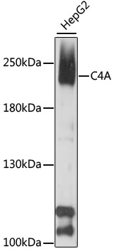 Western blot - C4A Polyclonal Antibody 