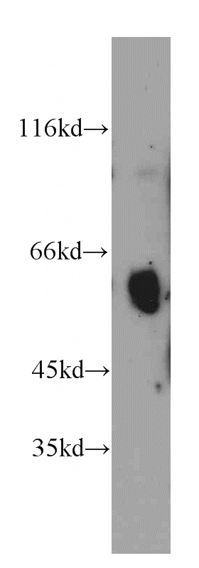 human heart tissue were subjected to SDS PAGE followed by western blot with Catalog No:116577(UMOD antibody) at dilution of 1:400