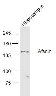 Fig1: Sample:; Hippocampus (Mouse) Lysate at 40 ug; Primary: Anti-Afadin at 1/1000 dilution; Secondary: IRDye800CW Goat Anti-Rabbit IgG at 1/20000 dilution; Predicted band size: 136 kD; Observed band size: 135/138 kD