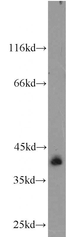 mouse testis tissue were subjected to SDS PAGE followed by western blot with Catalog No:115758(SYCE1 antibody) at dilution of 1:1000