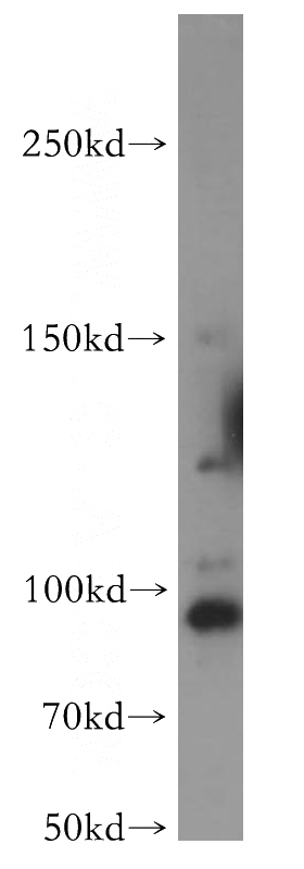 HeLa cells were subjected to SDS PAGE followed by western blot with Catalog No:115954(TEX10 antibody) at dilution of 1:500