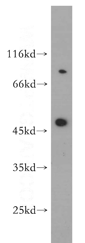 Raji cells were subjected to SDS PAGE followed by western blot with Catalog No:115190(SH3BP5 antibody) at dilution of 1:200