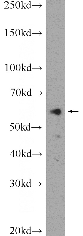 HL-60 cells were subjected to SDS PAGE followed by western blot with Catalog No:113221(C5orf23 Antibody) at dilution of 1:1000