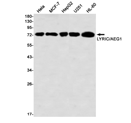 Western blot detection of LYRIC/AEG1 in Hela,MCF-7,HepG2,U251,HL-60 using LYRIC/AEG1 Rabbit mAb(1:1000 diluted)