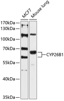 Western blot - CYP26B1 Polyclonal Antibody 