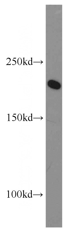 HeLa cells were subjected to SDS PAGE followed by western blot with Catalog No:114034(RPA1 antibody) at dilution of 1:1000