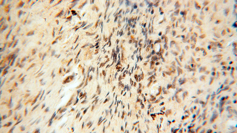 Immunohistochemical of paraffin-embedded human ovary using Catalog No:111356(HIRIP3 antibody) at dilution of 1:50 (under 40x lens)