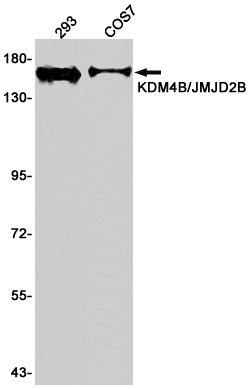 Western blot detection of KDM4B in 293,COS7 cell lysates using KDM4B/JMJD2B Rabbit pAb(1:1000 diluted).Predicted band size:122KDa.Observed band size:150KDa.