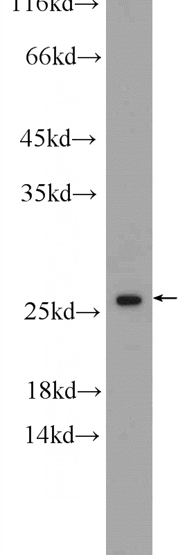 Jurkat cells were subjected to SDS PAGE followed by western blot with Catalog No:116436(TSN Antibody) at dilution of 1:600