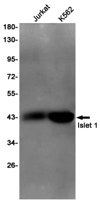 Western blot detection of Islet 1 in Jurkat,K562 cell lysates using Islet 1 Rabbit pAb(1:1000 diluted).Predicted band size:39KDa.Observed band size:39KDa.