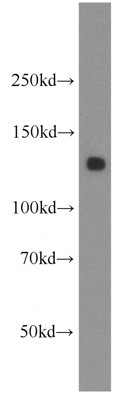 human stomach tissue were subjected to SDS PAGE followed by western blot with Catalog No:107999(AMOT antibody) at dilution of 1:500