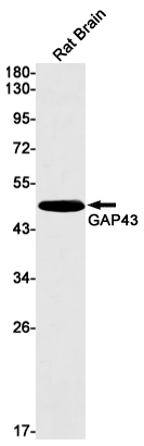 Western blot detection of GAP43 in Rat Brain lysates using GAP43 Rabbit mAb(1:1000 diluted).Predicted band size:25kDa.Observed band size:46kDa.