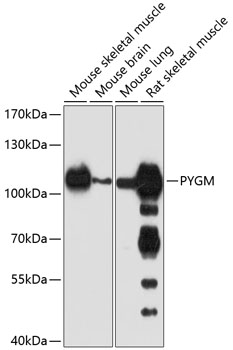 Western blot - PYGM Polyclonal Antibody 