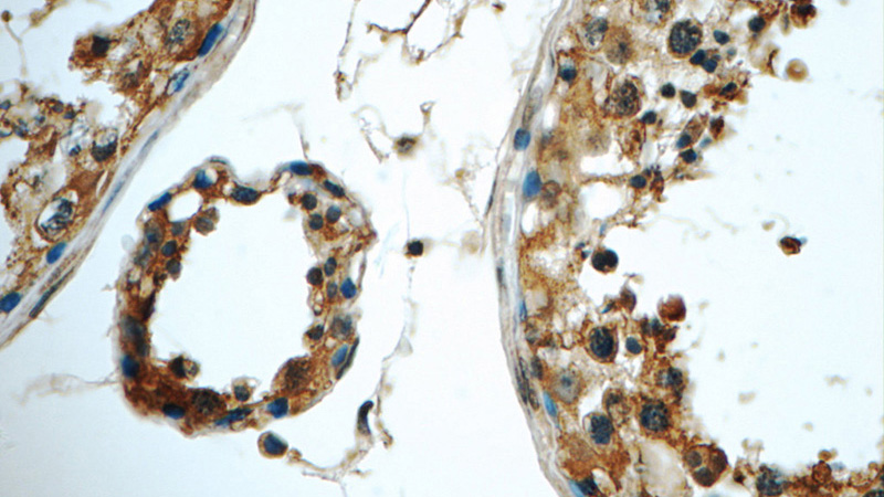 Immunohistochemistry of paraffin-embedded human testis tissue slide using Catalog No:116438(TSNAXIP1 Antibody) at dilution of 1:50 (under 40x lens)