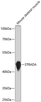 Western blot - STRADA Polyclonal Antibody 