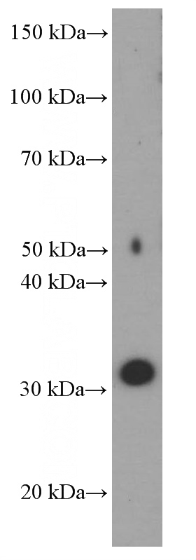 human testis tissue were subjected to SDS PAGE followed by western blot with Catalog No:107600(SRD5A1 Antibody) at dilution of 1:1000