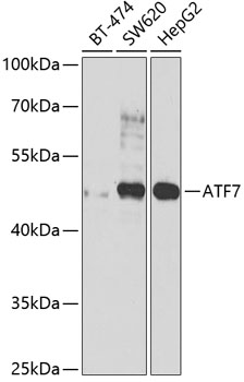 Western blot - ATF7 Polyclonal Antibody 