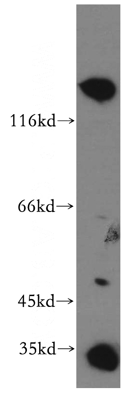 mouse kidney tissue were subjected to SDS PAGE followed by western blot with Catalog No:115588(SRGAP3-Specific antibody) at dilution of 1:300
