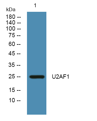 Fig1:; Western blot analysis of lysates from K562 cells, primary antibody was diluted at 1:1000, 4°over night.