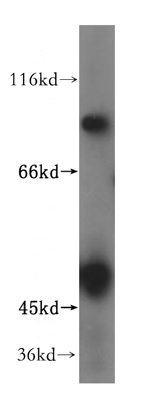 HEK-293 cells were subjected to SDS PAGE followed by western blot with Catalog No:117012(ZNF611 antibody) at dilution of 1:500