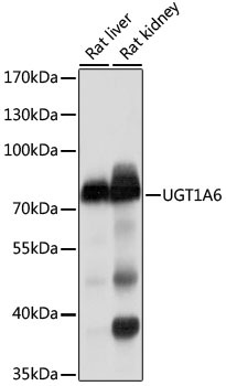 Western blot - UGT1A6 Polyclonal Antibody 