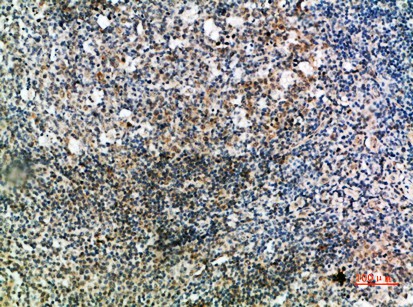 Fig1:; Immunohistochemical analysis of paraffin-embedded human-tonsil, antibody was diluted at 1:200