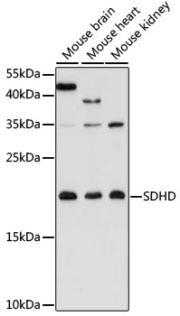 Western blot - SDHD Polyclonal Antibody 