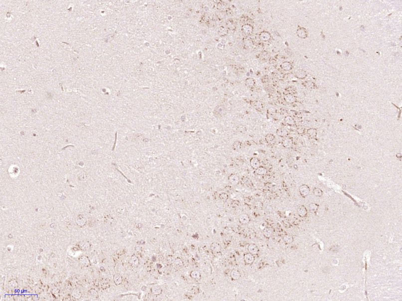 Fig5: Paraformaldehyde-fixed, paraffin embedded (Rat brain); Antigen retrieval by boiling in sodium citrate buffer (pH6.0) for 15min; Block endogenous peroxidase by 3% hydrogen peroxide for 20 minutes; Blocking buffer (normal goat serum) at 37℃ for 30min; Antibody incubation with (Gliomedin) Polyclonal Antibody, Unconjugated at 1:400 overnight at 4℃, followed by operating according to SP Kit(Rabbit) (sp-0023) instructionsand DAB staining.