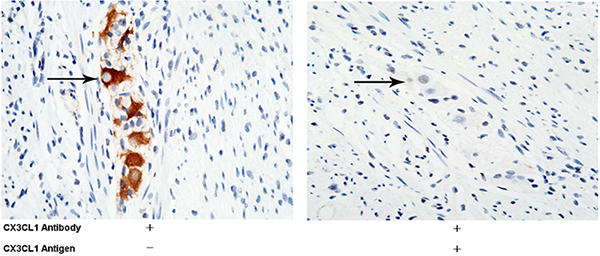 Fractalkine / CX3CL1 Antibody, Rabbit PAb, Antigen Affinity Purified, Immunohistochemistry