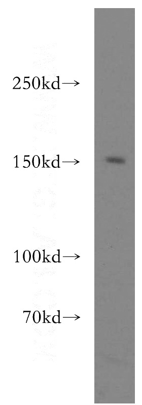 mouse brain tissue were subjected to SDS PAGE followed by western blot with Catalog No:110353(ERCC6 antibody) at dilution of 1:500