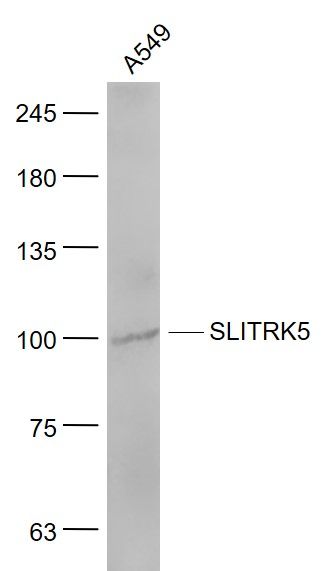 Fig1: Sample:; A549(Human) Cell Lysate at 30 ug; Primary: Anti- SLITRK5 at 1/1000 dilution; Secondary: IRDye800CW Goat Anti-Rabbit IgG at 1/20000 dilution; Predicted band size: 103 kD; Observed band size: 100 kD