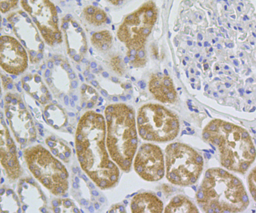 Fig2: Immunohistochemical analysis of paraffin-embedded human kidney tissue using anti-C1orf175 antibody. Counter stained with hematoxylin.