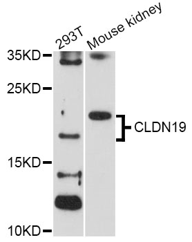 Western blot - CLDN19 Polyclonal Antibody 