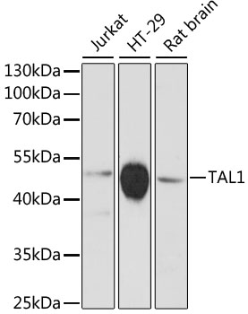 Western blot - TAL1 Polyclonal Antibody 