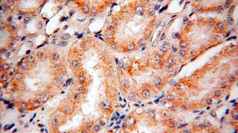 Immunohistochemical of paraffin-embedded human kidney using Catalog No:113726(PEX11G antibody) at dilution of 1:50 (under 40x lens)