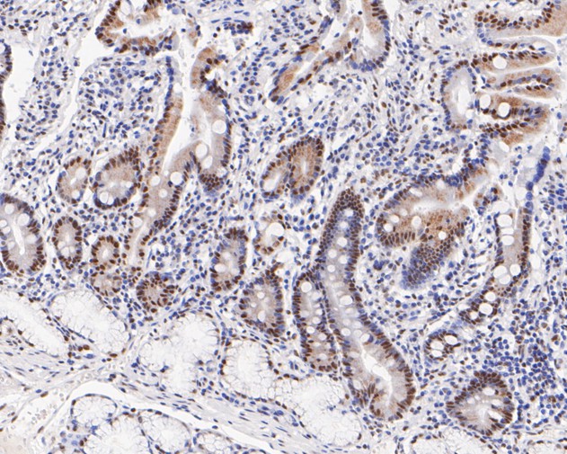 Fig9:; Immunohistochemical analysis of paraffin-embedded human small intestine tissue using anti-GATAD2A antibody. The section was pre-treated using heat mediated antigen retrieval with sodium citrate buffer (pH 6.0) for 20 minutes. The tissues were blocked in 5% BSA for 30 minutes at room temperature, washed with ddH; 2; O and PBS, and then probed with the primary antibody ( 1/200) for 30 minutes at room temperature. The detection was performed using an HRP conjugated compact polymer system. DAB was used as the chromogen. Tissues were counterstained with hematoxylin and mounted with DPX.