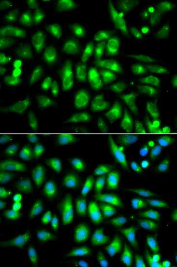 Immunofluorescence - CHRM2 Polyclonal Antibody 