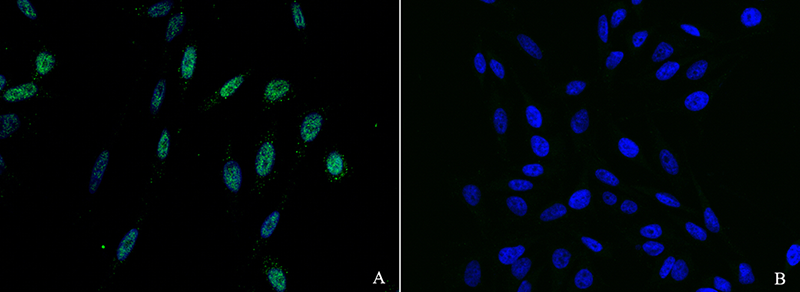 Troponin C / TNNC1 Antibody, Rabbit PAb, Antigen Affinity Purified, Immunofluorescence