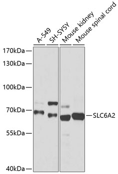 Western blot - SLC6A2 Polyclonal Antibody 