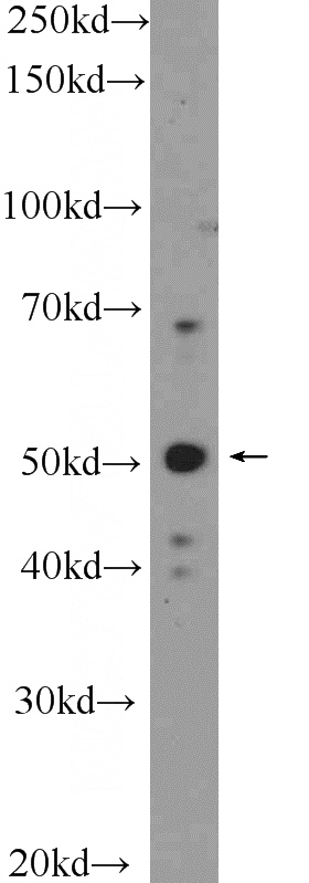 SH-SY5Y cells were subjected to SDS PAGE followed by western blot with Catalog No:116263(TPH1 Antibody) at dilution of 1:300
