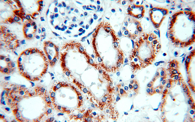 Immunohistochemical of paraffin-embedded human kidney using Catalog No:107973(ALDH6A1 antibody) at dilution of 1:50 (under 40x lens)