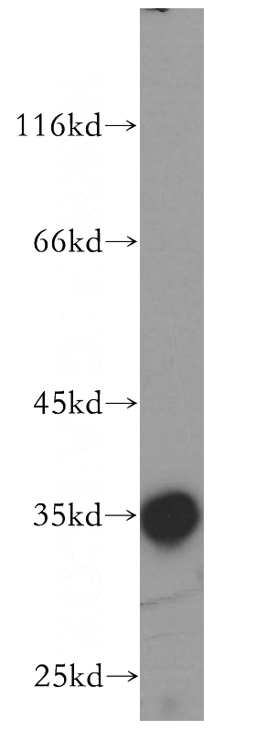mouse lung tissue were subjected to SDS PAGE followed by western blot with Catalog No:114075(P11 antibody) at dilution of 1:600