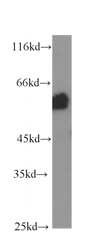 HeLa cells were subjected to SDS PAGE followed by western blot with Catalog No:107568(AKT antibody) at dilution of 1:1000