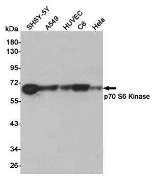 Western blot analysis of p70 S6 Kinase expression in SHSY-5Y,A549,HUVEC,C6 and Hela cell lysates using p70 S6 Kinase antibody at 1/1000 dilution.Predicted band size:70KDa.Observed band size:70KDa.