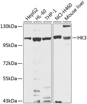 Western blot - HK3 Polyclonal Antibody 