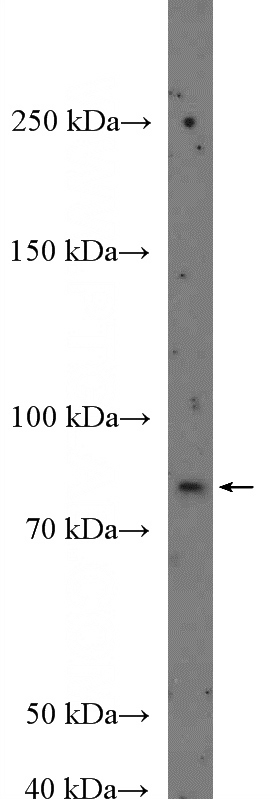 A431 cells were subjected to SDS PAGE followed by western blot with Catalog No:117272(ZXDA Antibody) at dilution of 1:300
