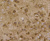 Fig4: Immunohistochemical analysis of paraffin- embedded mouse brain tissue using anti-BMP11 rabbit polyclonal antibody.