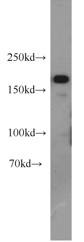 HeLa cells were subjected to SDS PAGE followed by western blot with Catalog No:112029(KDM5C antibody) at dilution of 1:500
