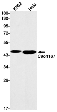 Western blot detection of C9orf167 in K562,Hela cell lysates using C9orf167 Rabbit mAb(1:1000 diluted).Predicted band size:47kDa.Observed band size:47kDa.